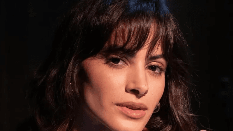 Ator Letícia Salles sofre ataque de cães no Rio