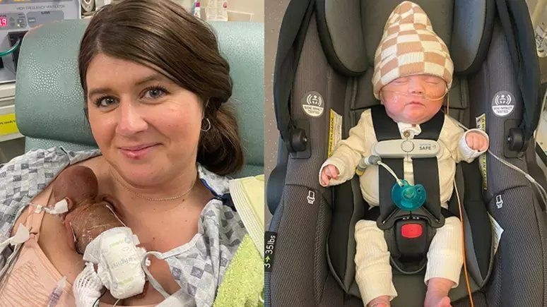 Bebê mais prematuro do mundo comemora 1 ano de vida