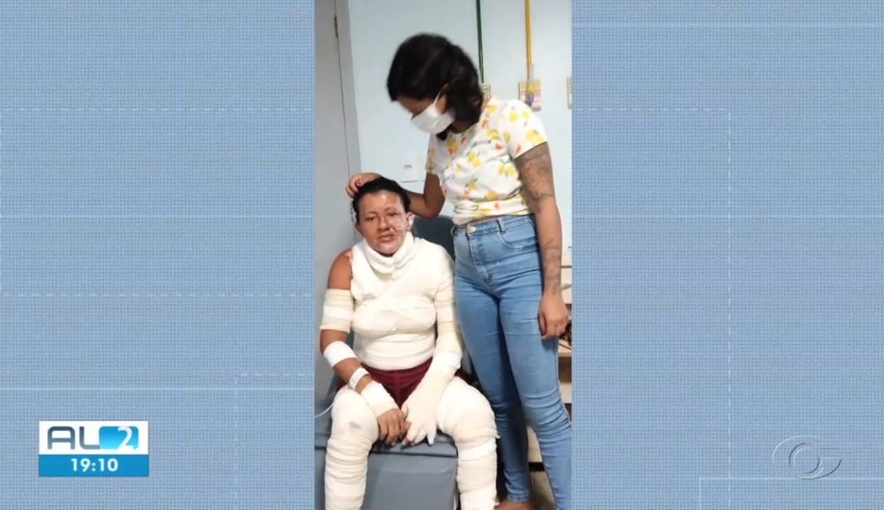 Feminicídio em Alagoas: mulher sofreu queimaduras graves