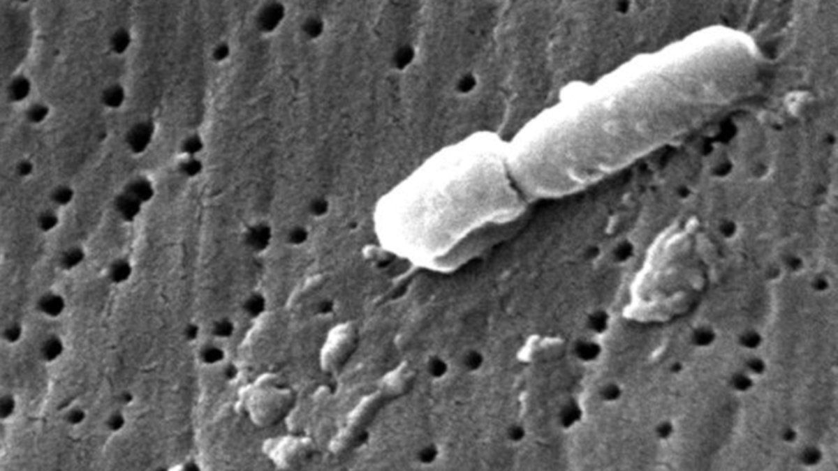 Superbactérias em São Paulo oferecem riscos à saúde pública
