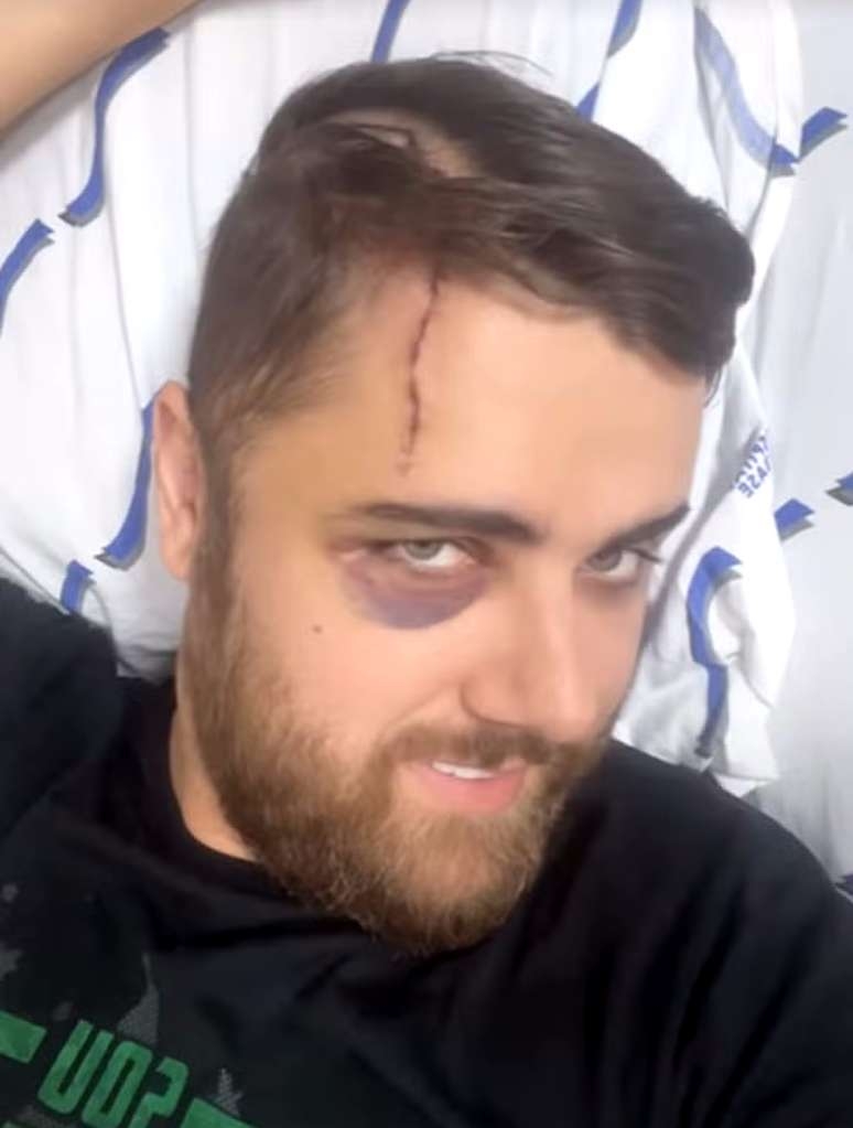 Zé Neto recebe alta hospitalar após acidente