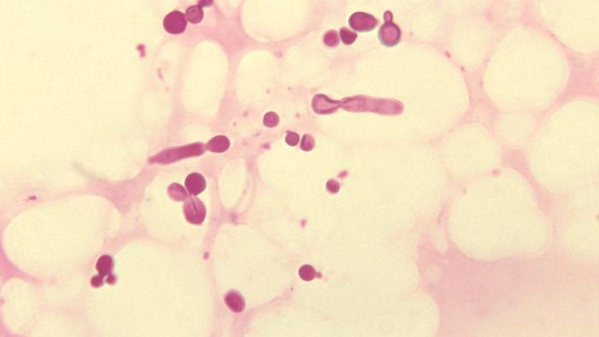 Fungo na pele combate superbactéria mortal eficazmente