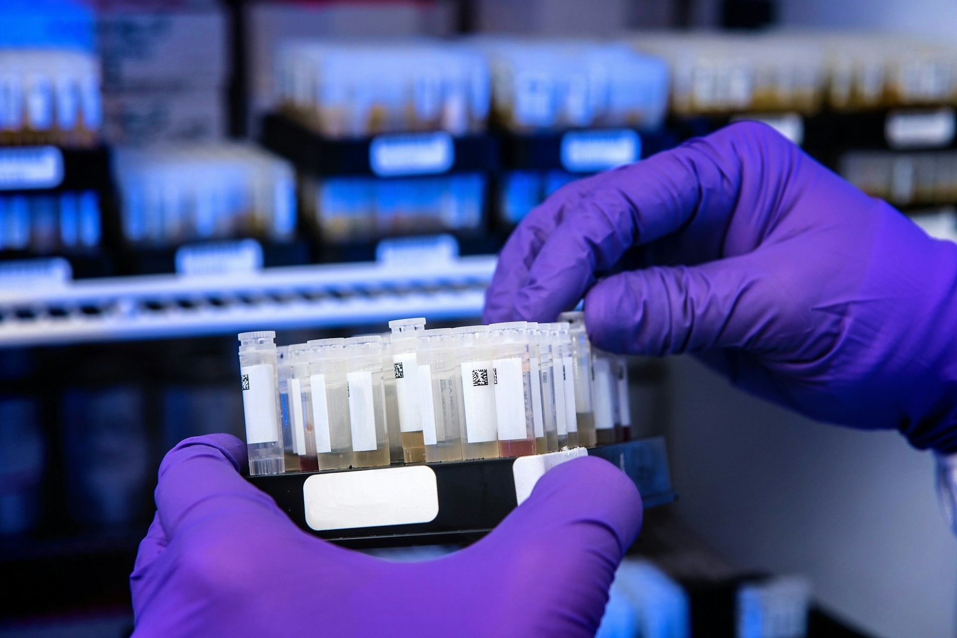 Teste molecular de HPV pode substituir Papanicolau no SUS
