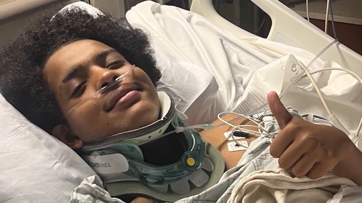 Adolescente sobrevive após ser atingido por raio no Central Park