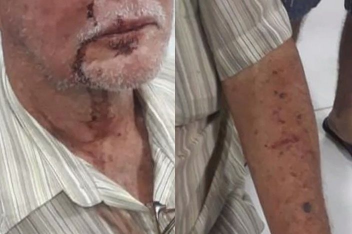 Família de idoso denuncia agressão após reclamação por som alto de vizinha, na Chã de Bebedouro