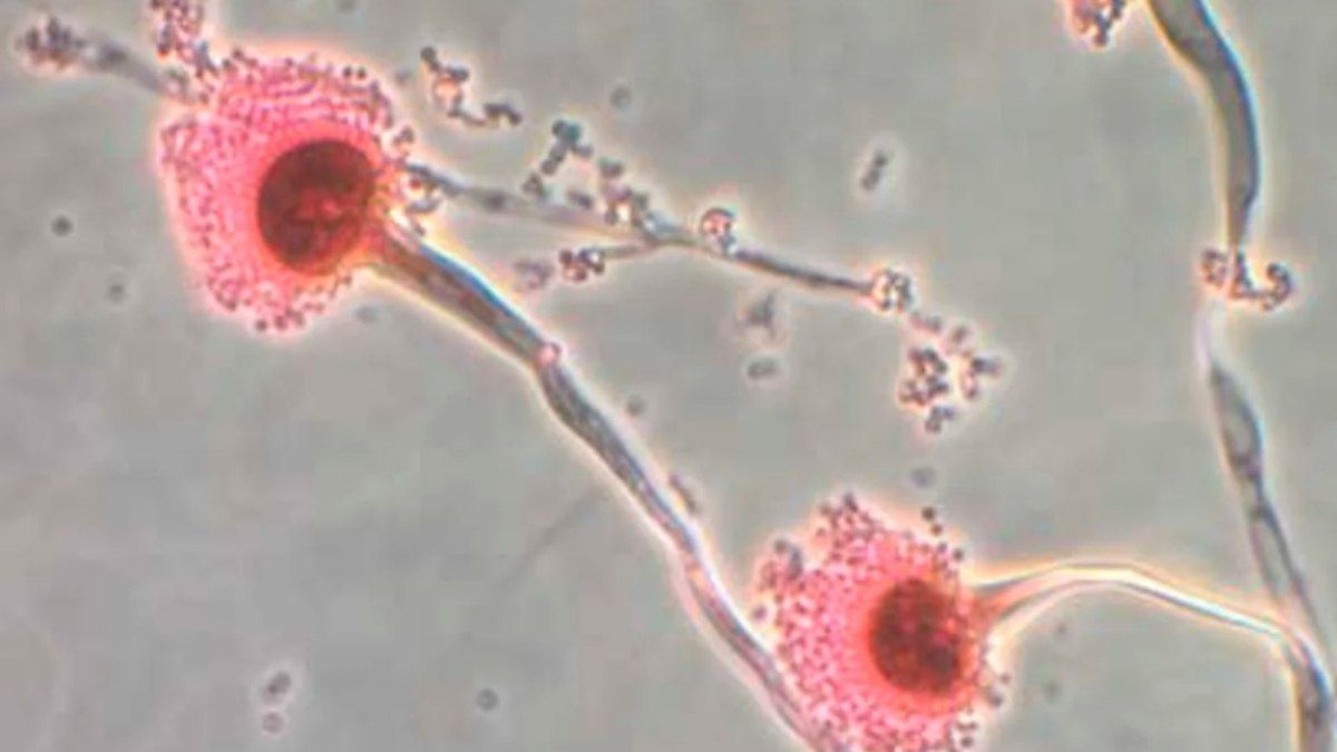 Fungo desafiador avança globalmente e preocupa especialistas