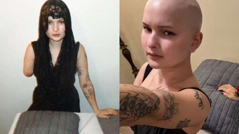 Influenciadora com câncer grave amputa braço e realiza celebração fúnebre