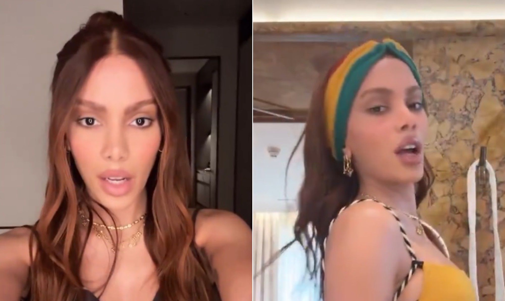 Anitta revela novos procedimentos estéticos surpreendentes