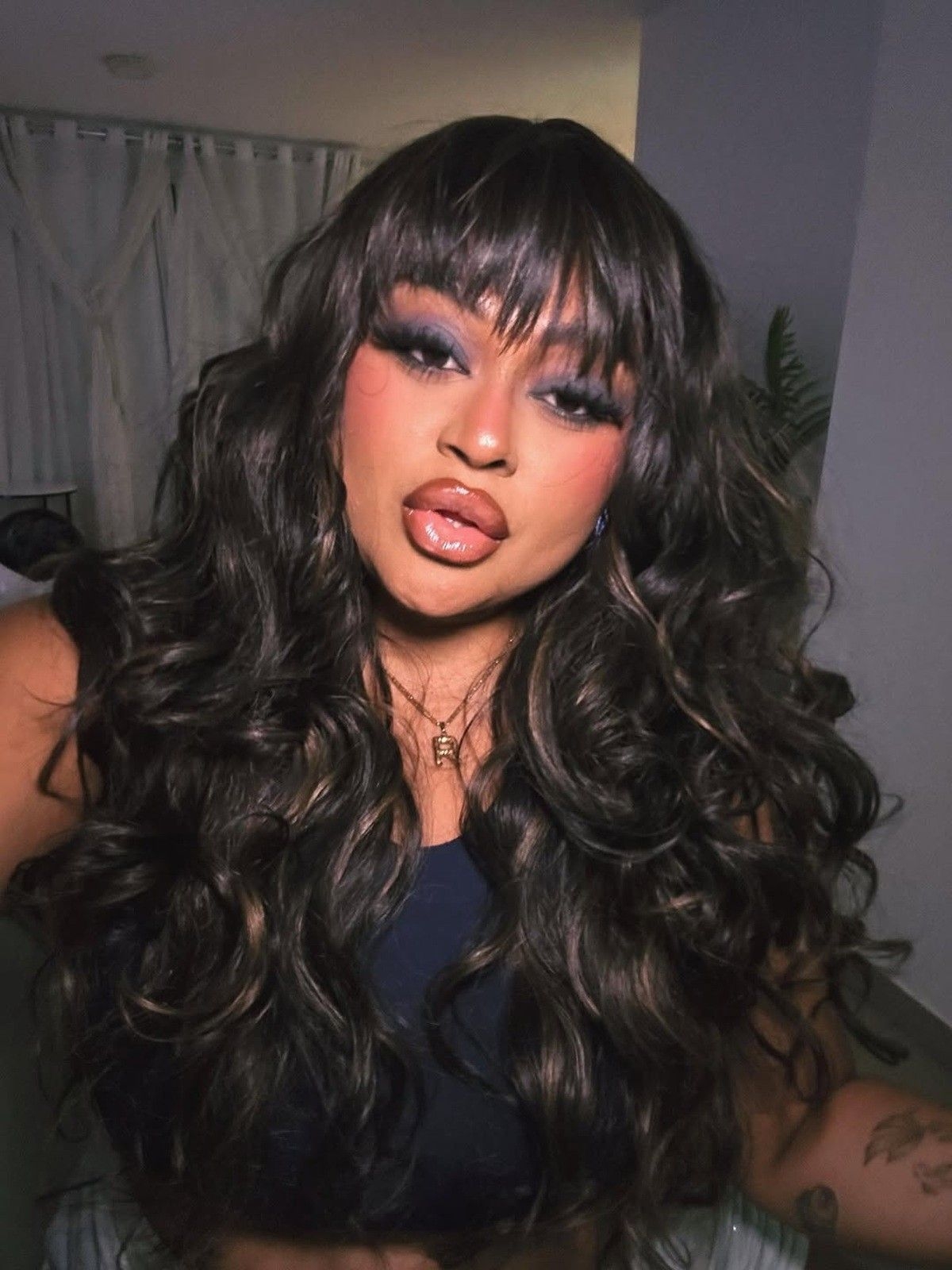 Rízia Cerqueira se recupera após acidente com moto elétrica