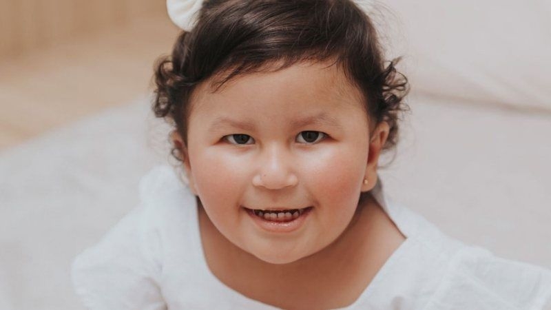 Síndrome de Prader-Willi causa fome insaciável em criança