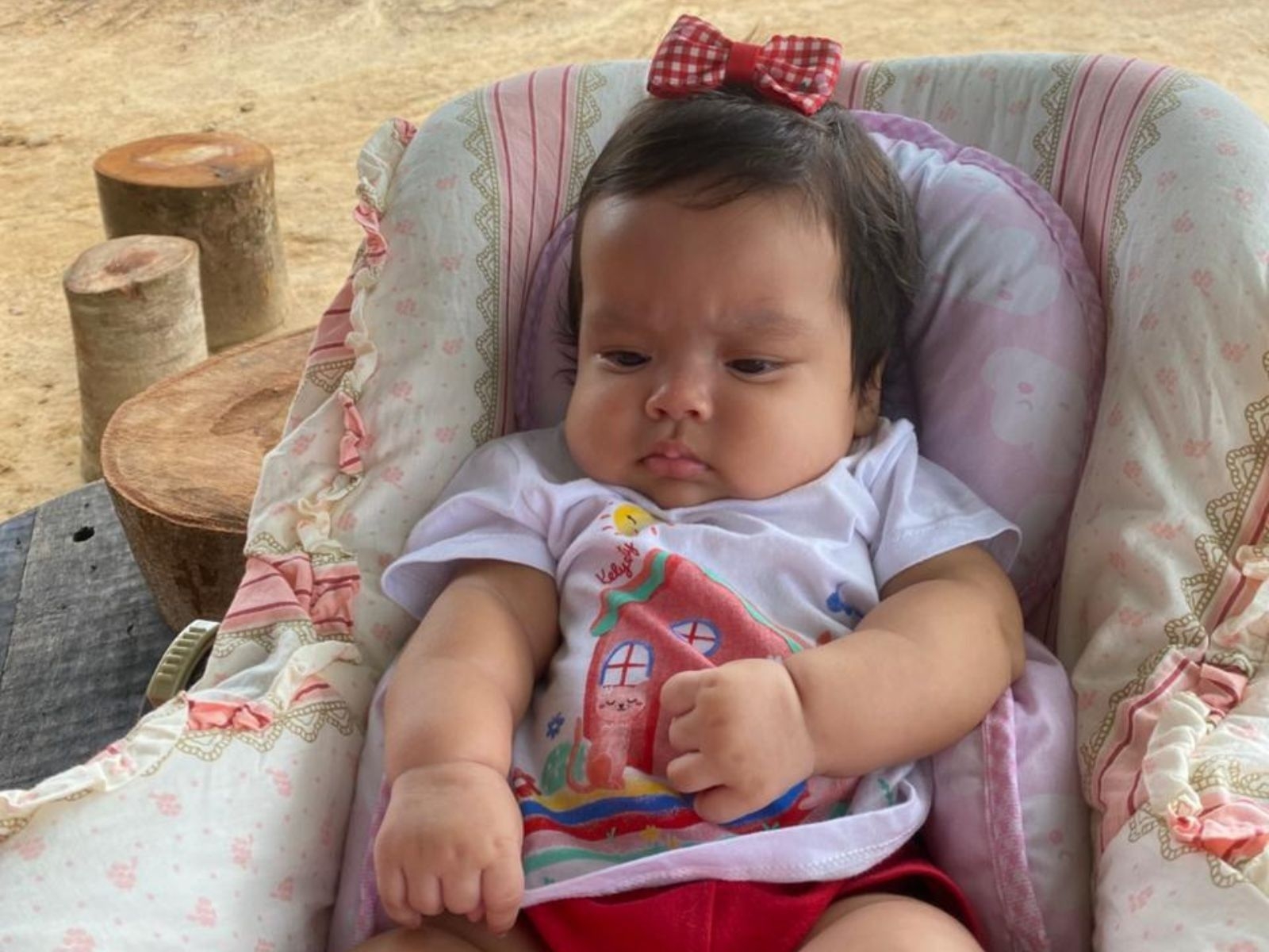 Bebê de 3 meses é diagnosticada com tumor no cérebro