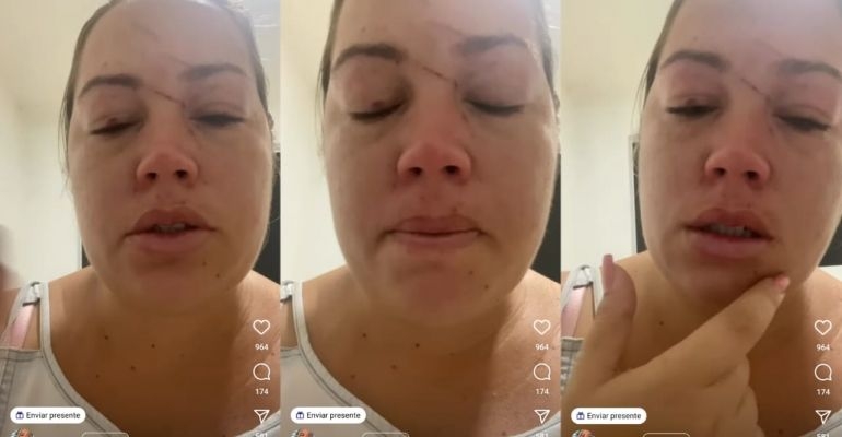 Motorista por aplicativo denuncia que foi agredida por passageiros em Maceió