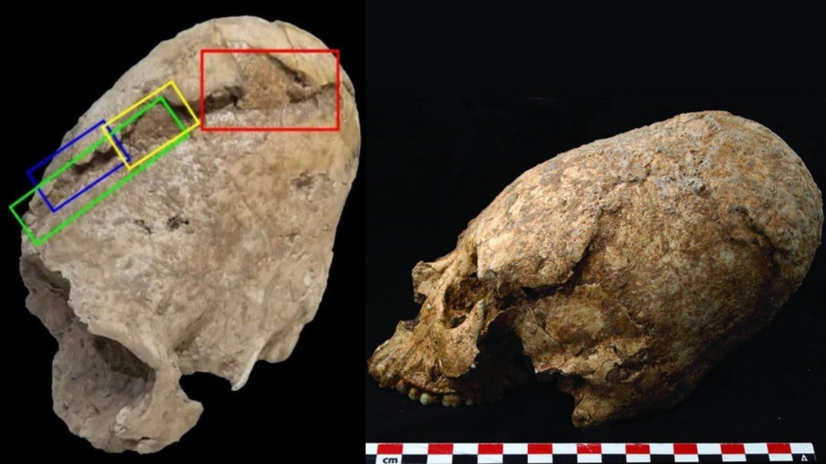 Crânio pré-histórico em formato de cone é descoberto no Irã