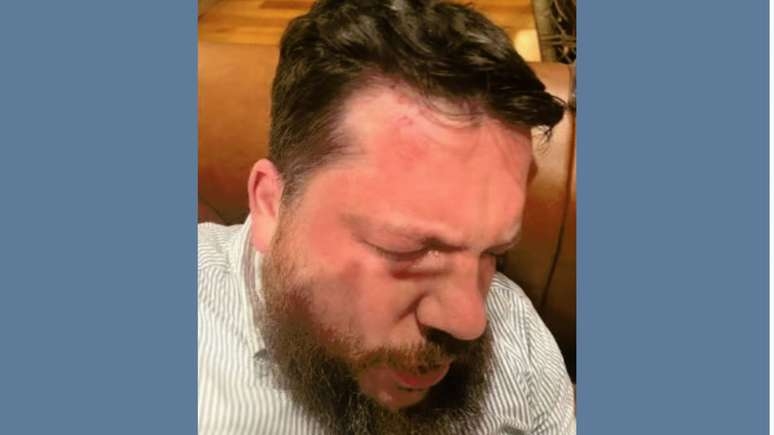 Leonid Volkov, opositor russo e aliado de Navalny, é agredido com martelo