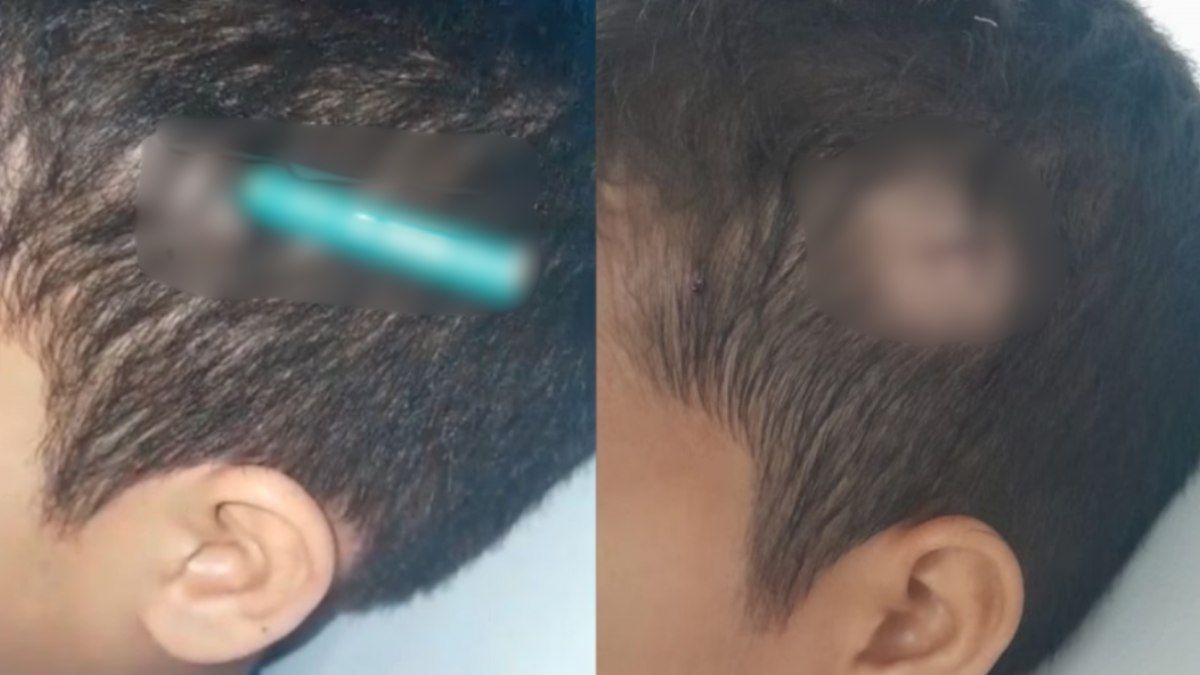 Aluno é agredido com lápis em escola de SP