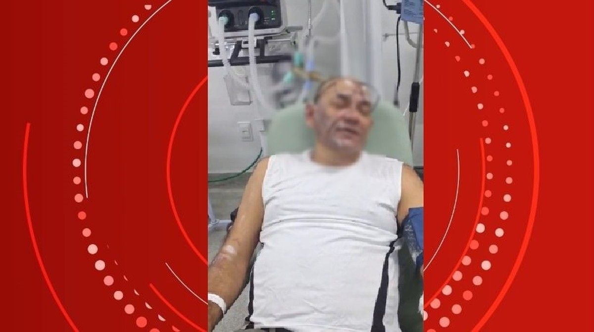 Sargento da PM é ferido por óleo quente em Maceió