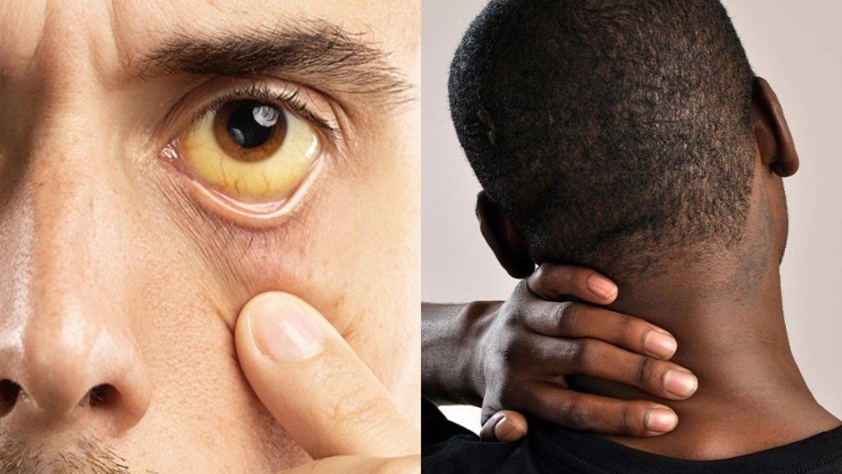 Julho Amarelo e Verde conscientiza sobre hepatites e câncer