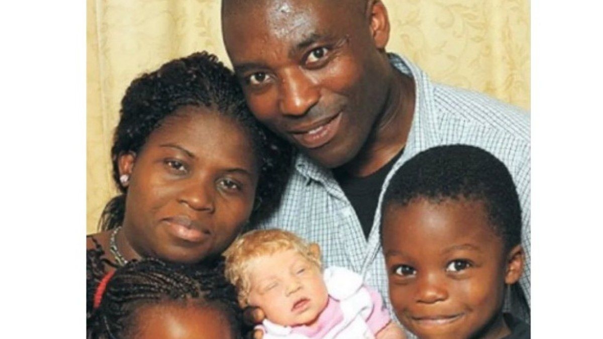 Bebê Nascida de Pais Nigerianos Intriga Cientistas