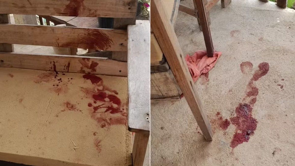 Bebê de 10 meses morre após ataque de pitbull no Rio