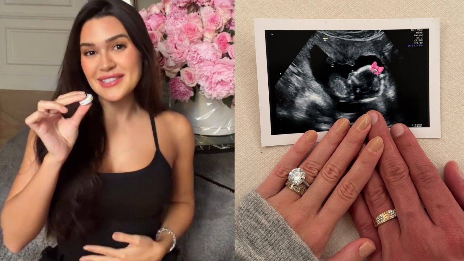 Franciny Ehlke revela nome e significado da filha
