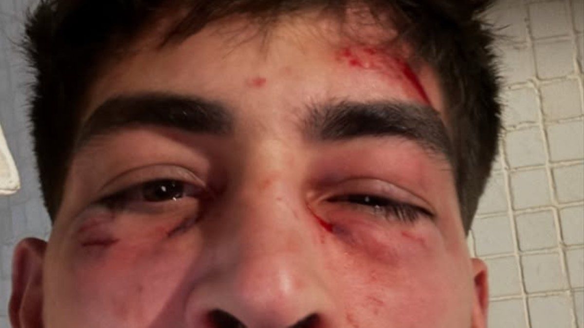 Empresário relata agressão em karaokê de São Paulo