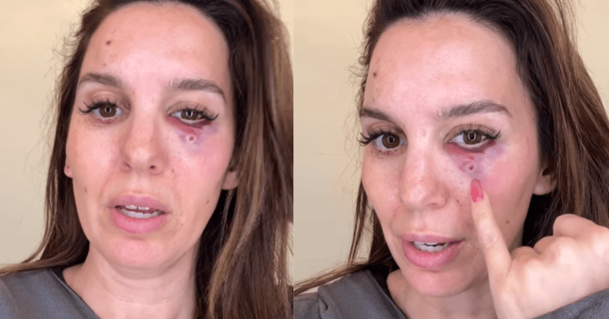 Christy Carlson Romano é ferida em festa de aniversário