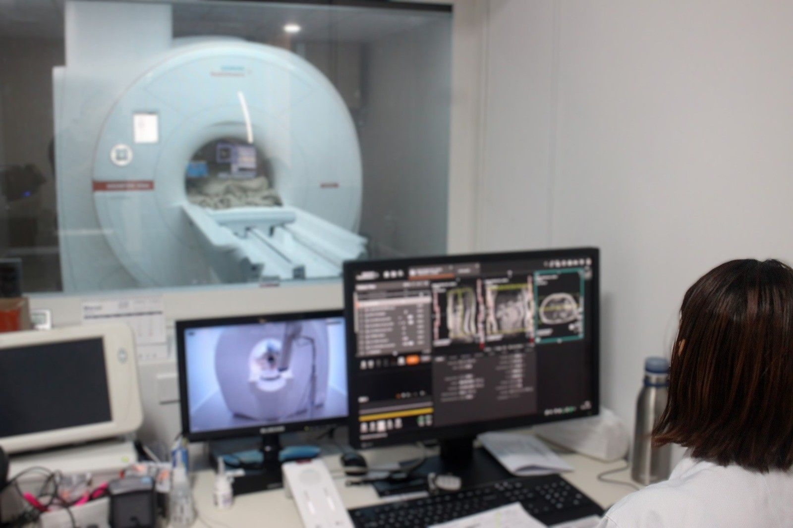 Retorno dos Exames de Imagem da Unimed na Santa Casa