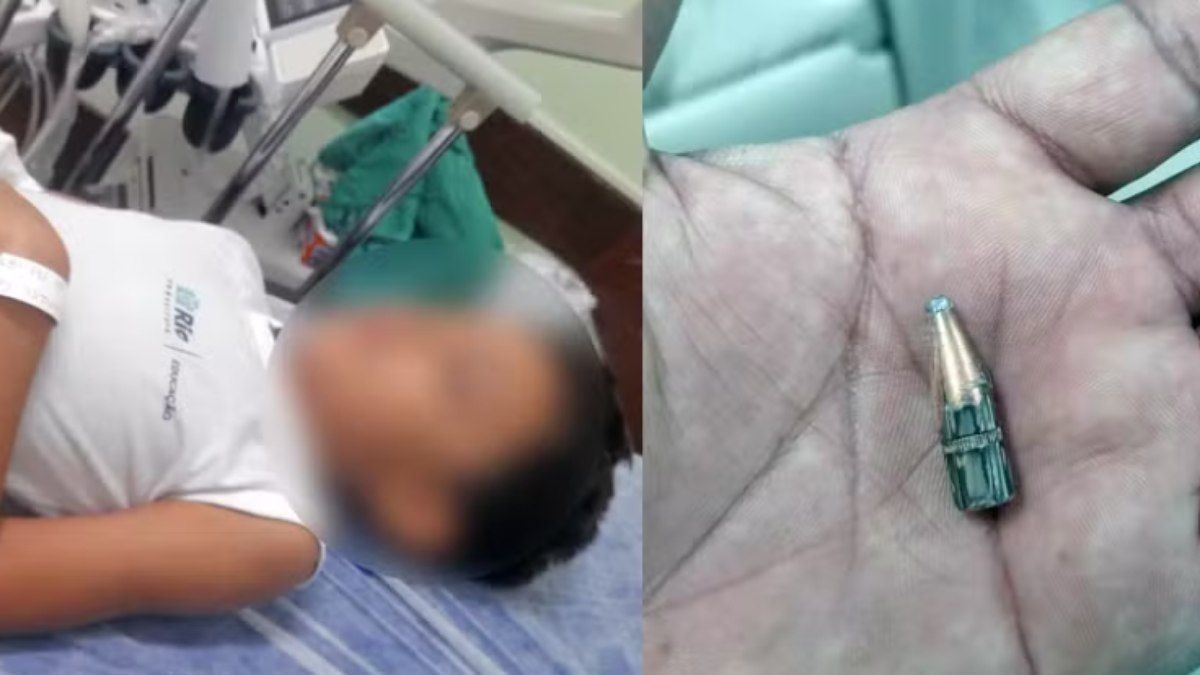 Menino de 7 anos é ferido por bala perdida em escola